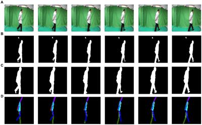 Machine vision-based gait scan method for identifying cognitive impairment in older adults